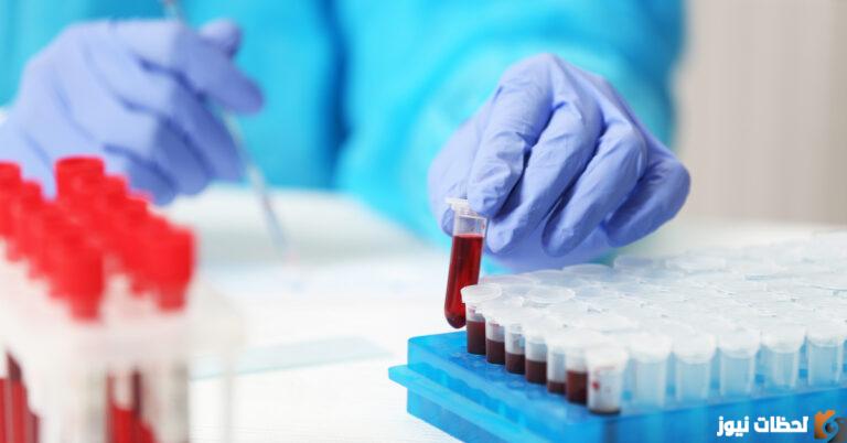 ماذا يعني ارتفاع تحليل Calprotectin؟ سعر تحليل calprotectin في مصر 2025 تحليل calprotectin