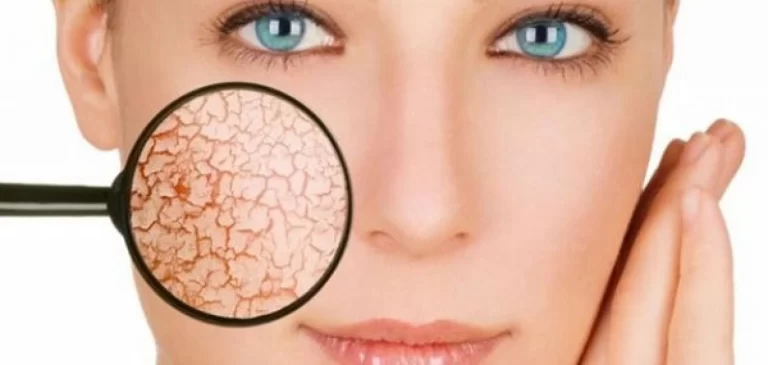 افضل دكتور جلدية بالكويت
