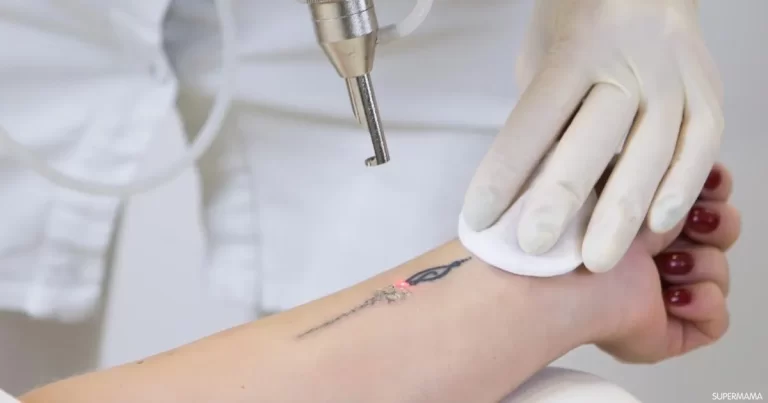حكم التاتو المؤقت ابن باز