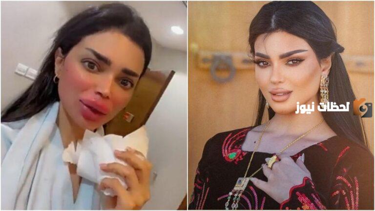 صور أودي الزبن قبل التجميل