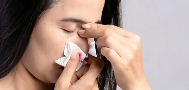 ما أسباب نزول دم من الأنف مع دوخة وصداع؟