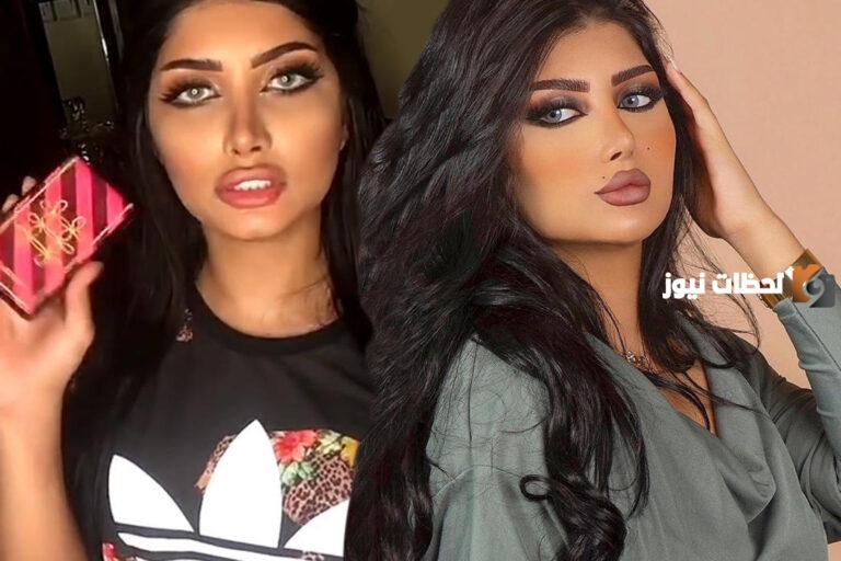 صور ملكة كابلي قبل التجميل وبعده