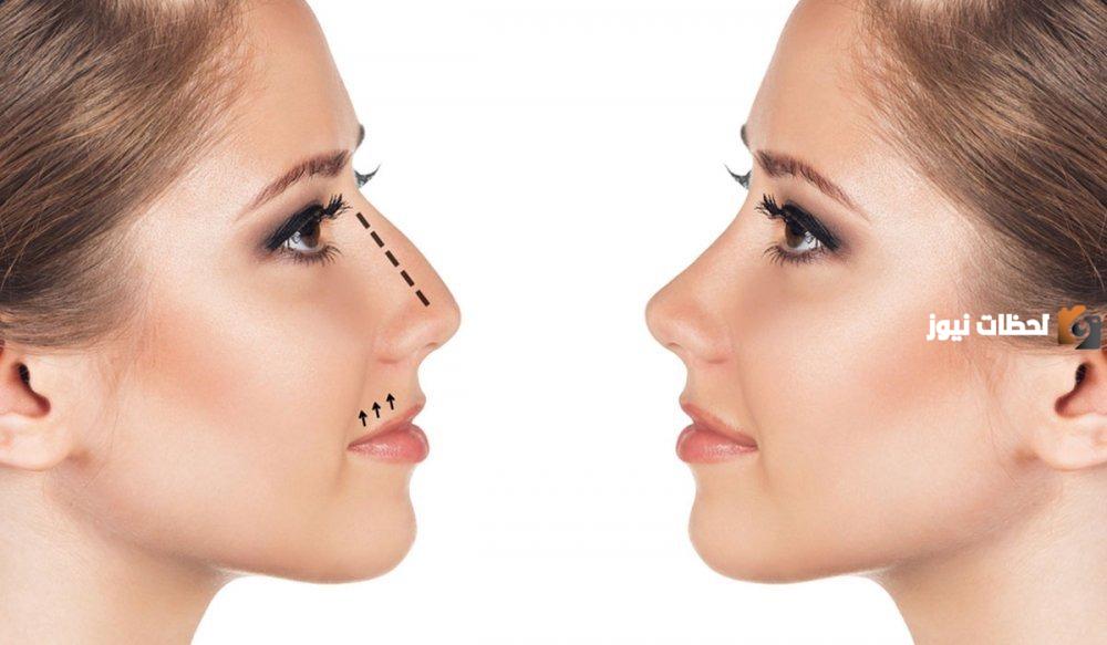 ما هي تكلفة عملية تجميل الانف في مستشفى الحبيب
