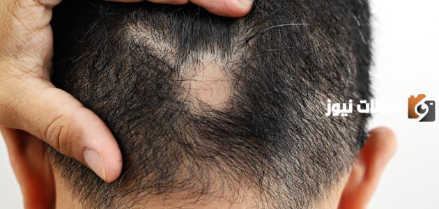 متى تكون بداية ظهور الشعر بعد الثعلبة؟