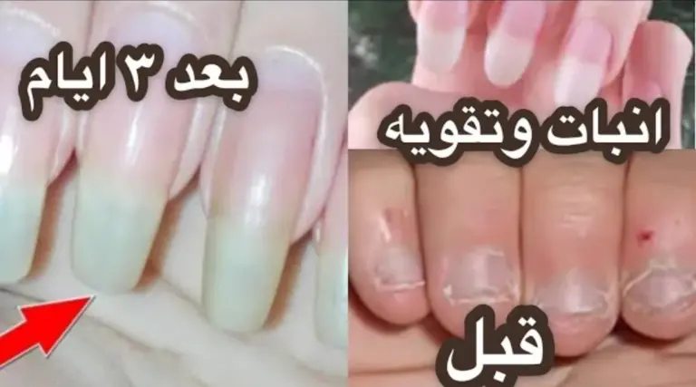 بدون اكليرك.. أفضل وصفة لتطويل الاظافر بسرعة