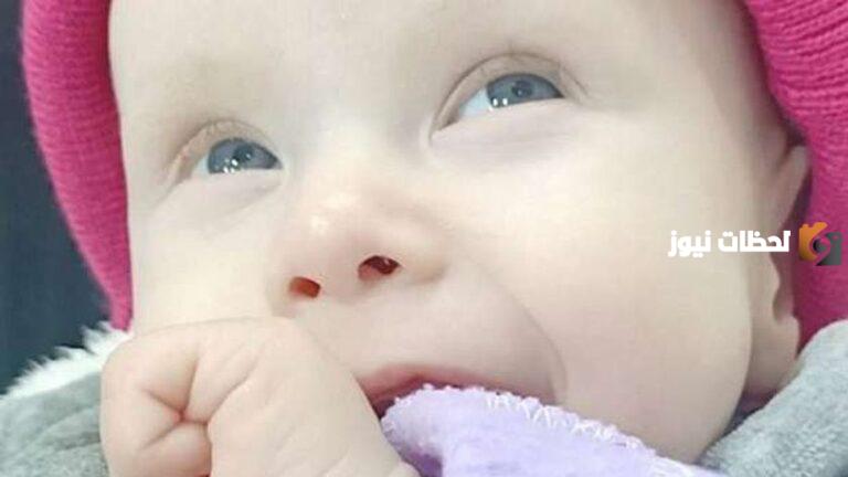 أهم معلومات عن متلازمة مينكيس” Menkes syndrome