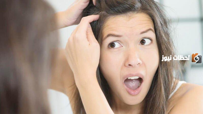 علاج ظهور الشعر الأبيض في سن الثلاثين