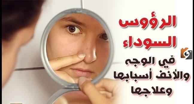 عن تجربة .. وصفة رهيبة لتنظيف الوجه والأنف من الرؤوس السوداء