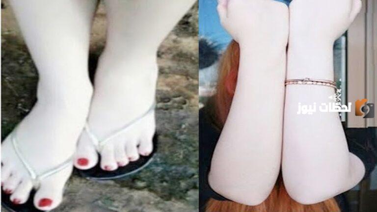 وصفة لتبييض اليدين والرجلين بشكل غير متوقع