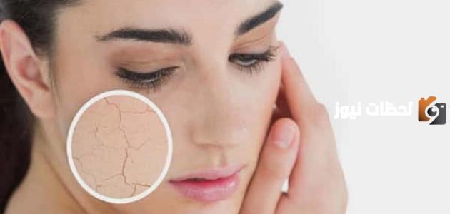 طرق العناية بالبشرة الجافة