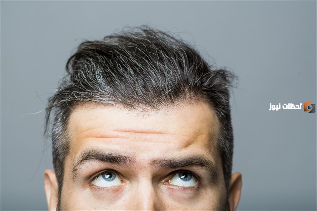 علاج الشعر الأبيض والتخلص منه
