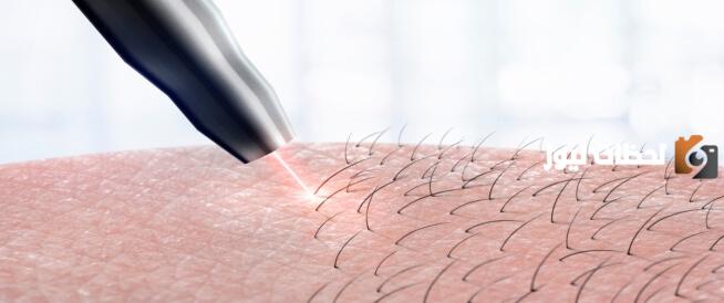  كريم لإزالة الشعر للمنطقة للحساسة