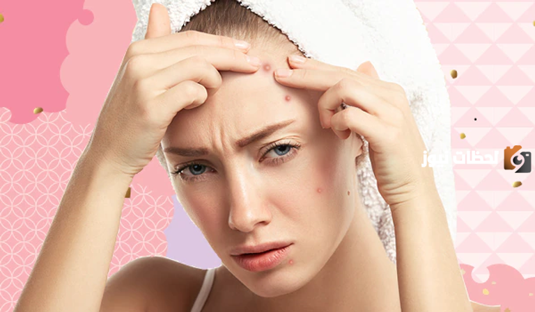 هذا علاج الحبوب البيضاء الصغيرة في الوجه