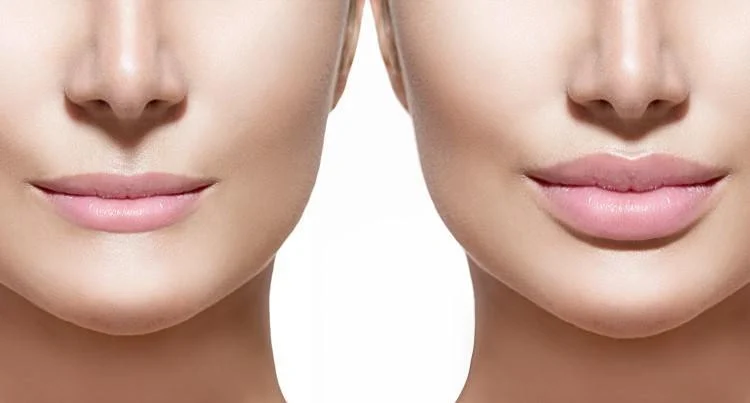كيف أحصل علي شفاه جذابة بدون عمليات تجميلية للوجه