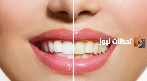علاج اصفرار الأسنان ب 9 وصفات للتخلص من اصفرار الأسنان في المنزل