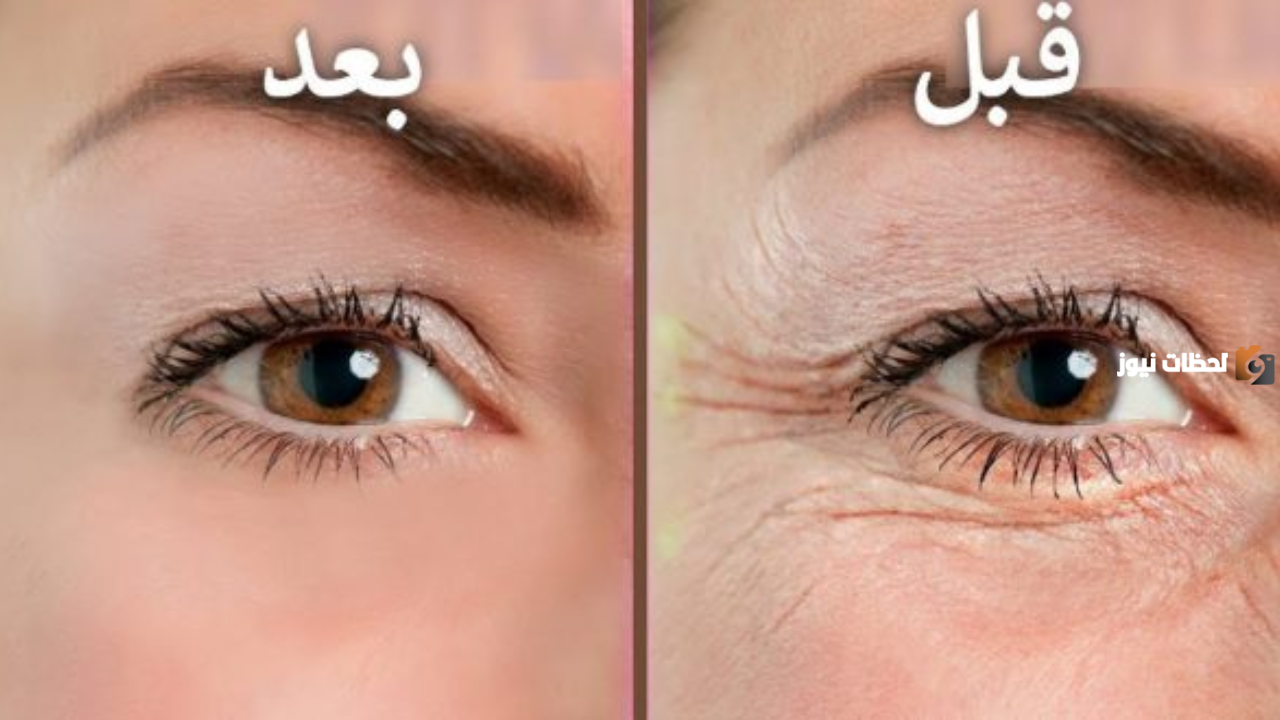  وصفات للقضاء على التجاعيد بالوجه 