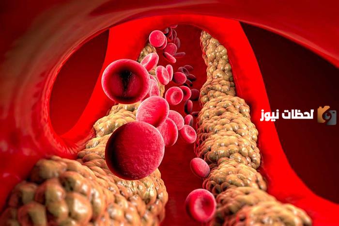 علاج الدهون الثلاثية