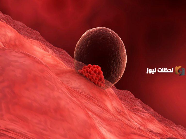 اعراض ما بعد ارجاع الاجنه