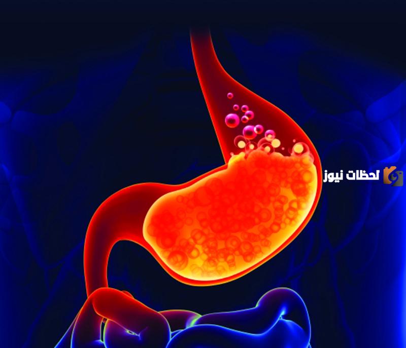 علاج ارتجاع العصارة الصفراوية