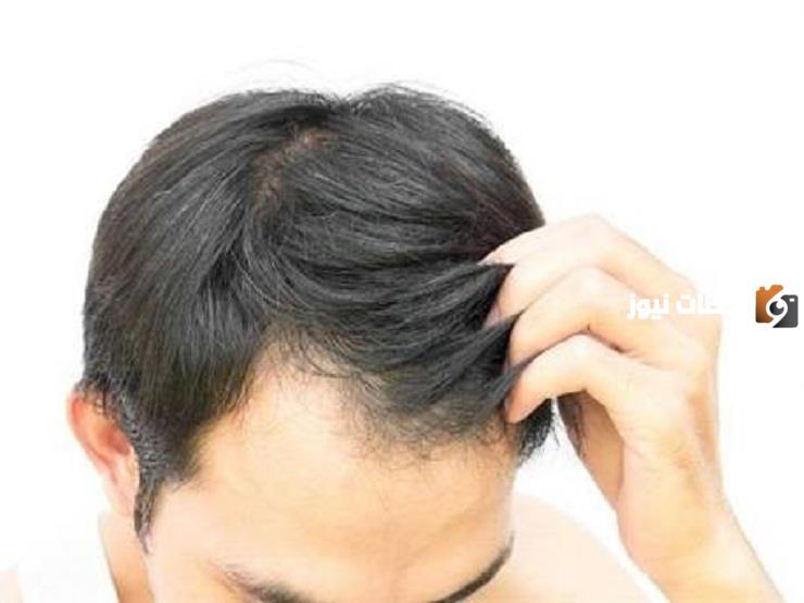  صبغ شعر الرجل