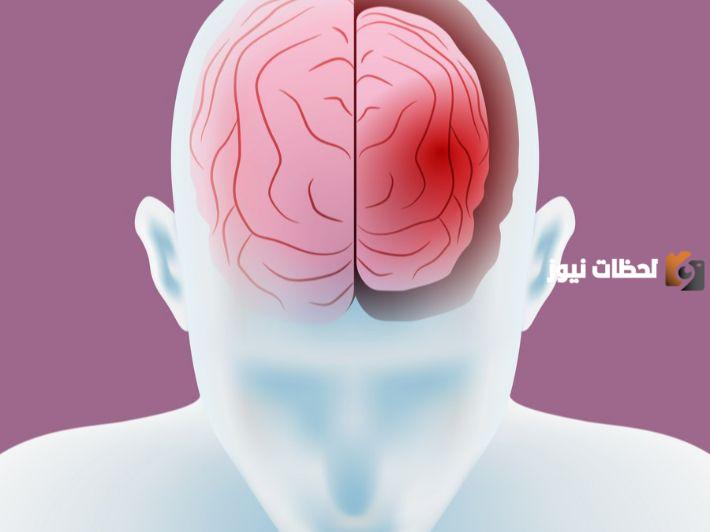 ضمور المخ