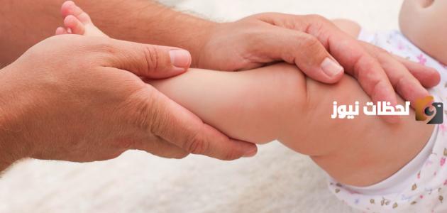 ما هي أسباب وعلاج القدم الحنفاء عند الأطفال