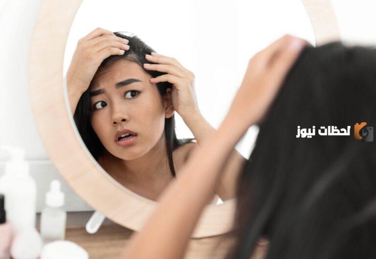 ما هو علاج الصلع الوراثي عند النساء طبيعياً