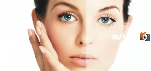 أضرار وضع كريم تفتيح البشرة بعد التعرض للشمس