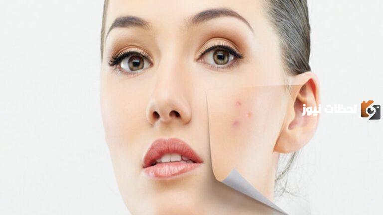 ما هي طريقة علاج البقع الداكنة في الوجه