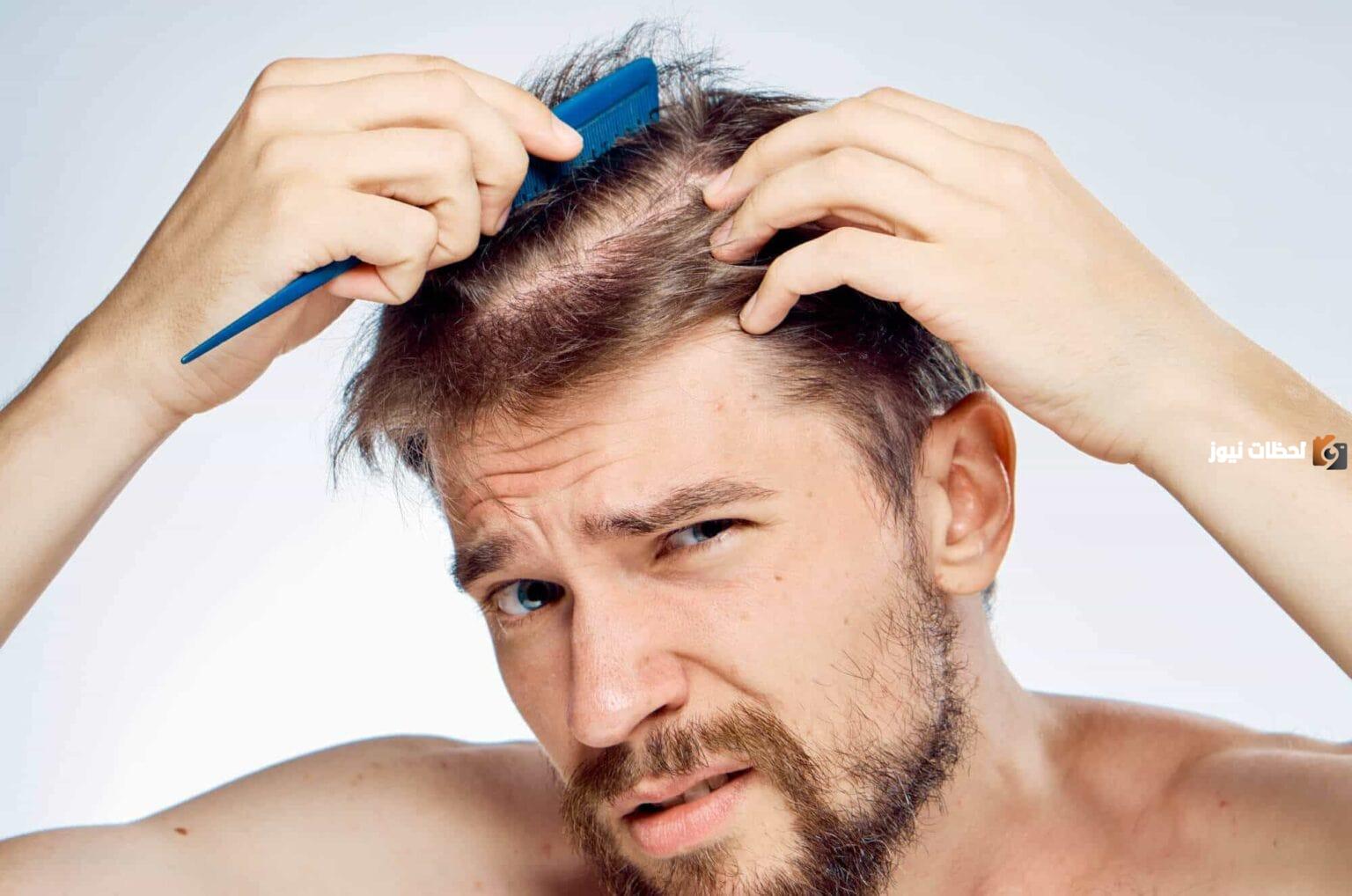 ما هى طريقة علاج الصلع المبكر عند الشباب
