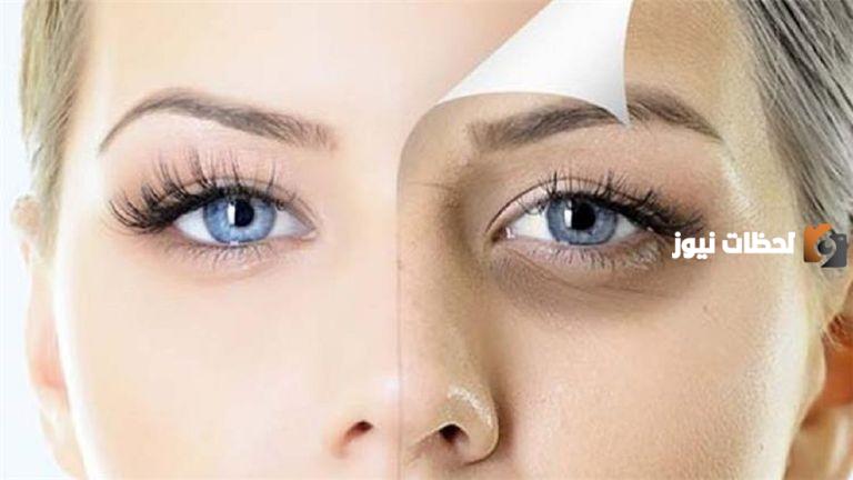 طريقة علاج الهالات السوداء حول العين أسباب