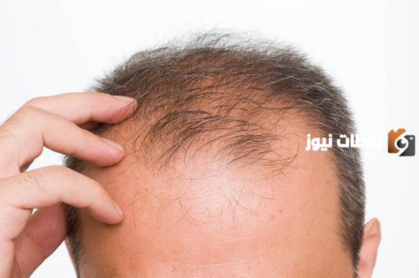 علاج تساقط الشعر للرجال