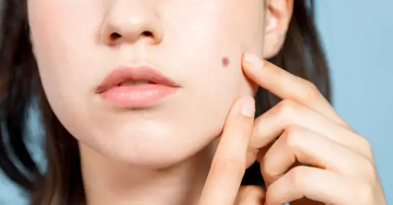 على ماذا تدل الحبوب في الوجه؟ علامات تدل على مشاكل صحية