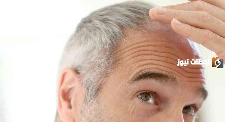 هل يوجد علاج للشعر الأبيض دائم