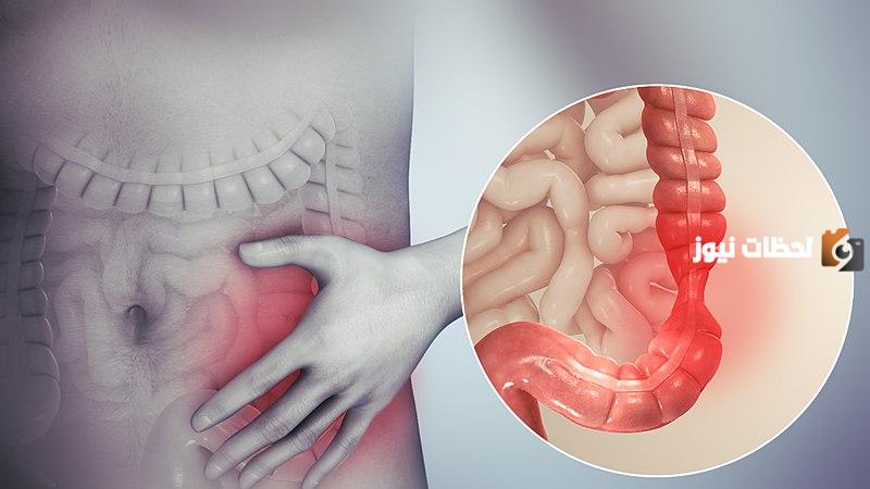 علاج القولون بالأعشاب