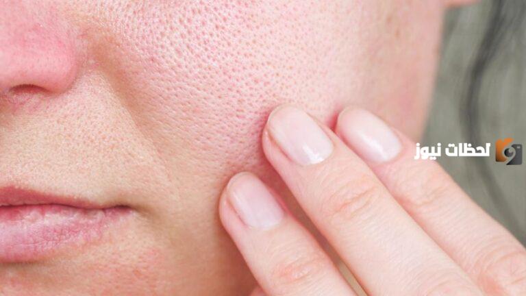 إليك ماسك يصغر المسام وأفضل المكونات المستخدمة به