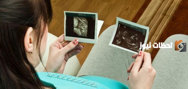 في أي أسبوع من الحمل ينزل رأس الجنين في الحوض