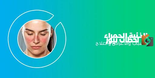 هل يمكن الشفاء من مرض الذئبة الحمراء؟ طرق علاج مرض الذئبة الحمراء