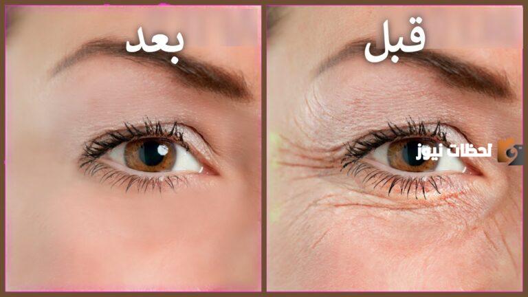 33+ وصفات للتخلص من التجاعيد والانتفاخ تحت العين 2025