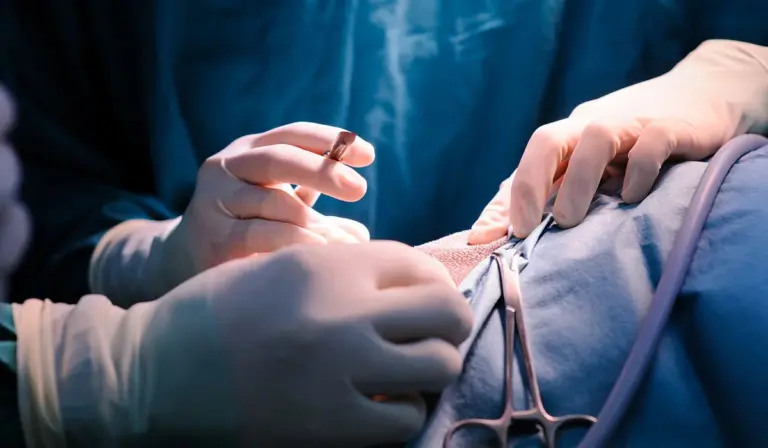 إليك أسباب استئصال الرحم
