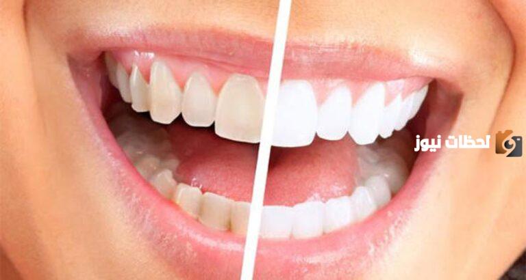 ما هي أفضل طرق لعلاج اصفرار الأسنان ووصفات طبيعية للأسنان
