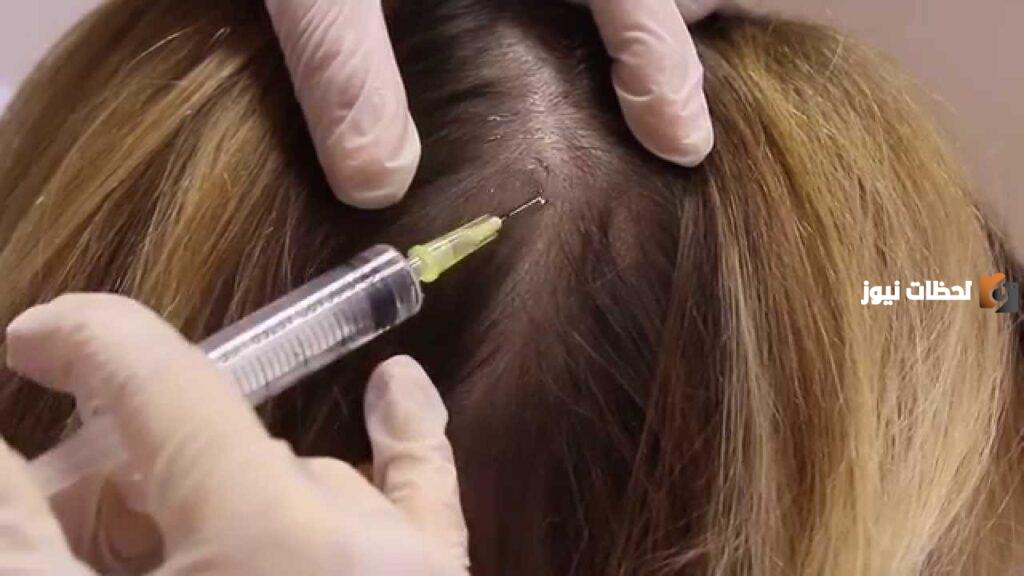 هذه فوائد الميزوثيرابي للشعر الخفيف وأضرارة