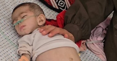 وفاة طفلة في غزة بسبب الجوع وارتفاع عدد الضحايا الأطفال إلى 54.